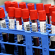 Image for article titled Promising Gene Therapy Trials Suspended Over Potential Cancer Risk